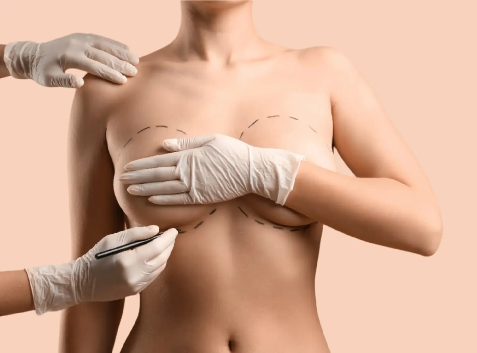 Liposuction body contouring treatment