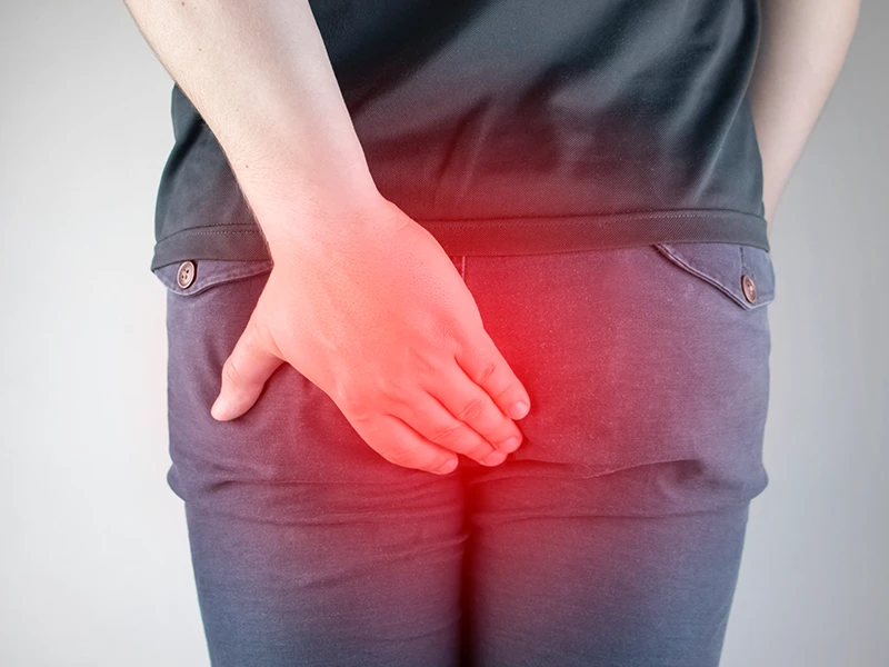 Anal fissure treatment specialist consultation