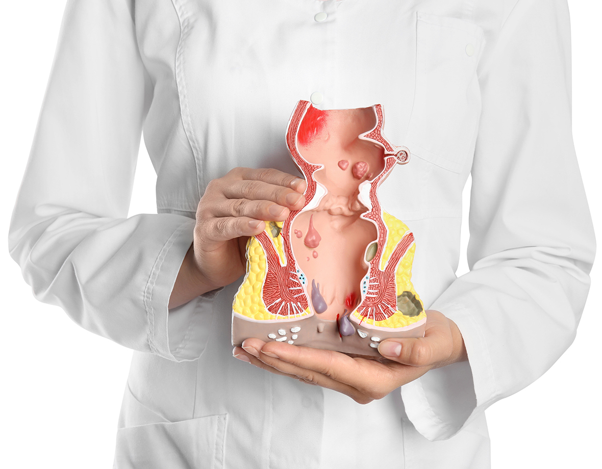 Anal fissure diagnosis and care