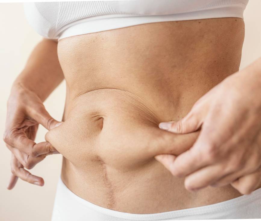 Tummy tuck abdominoplasty procedure